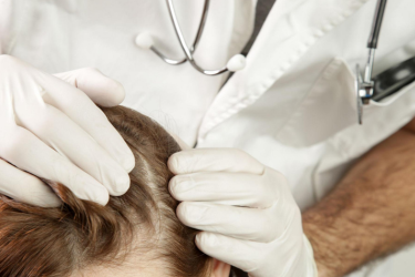 Hair and Nail Disease Treatment - Kshitij Skin Clinic